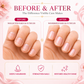 Nail & Cuticle Oil with Jojoba Oil - Heals Redness & Pain - Strengthens Thin & Brittle Nails (3 x 10 ml/ 0.4 fl oz)